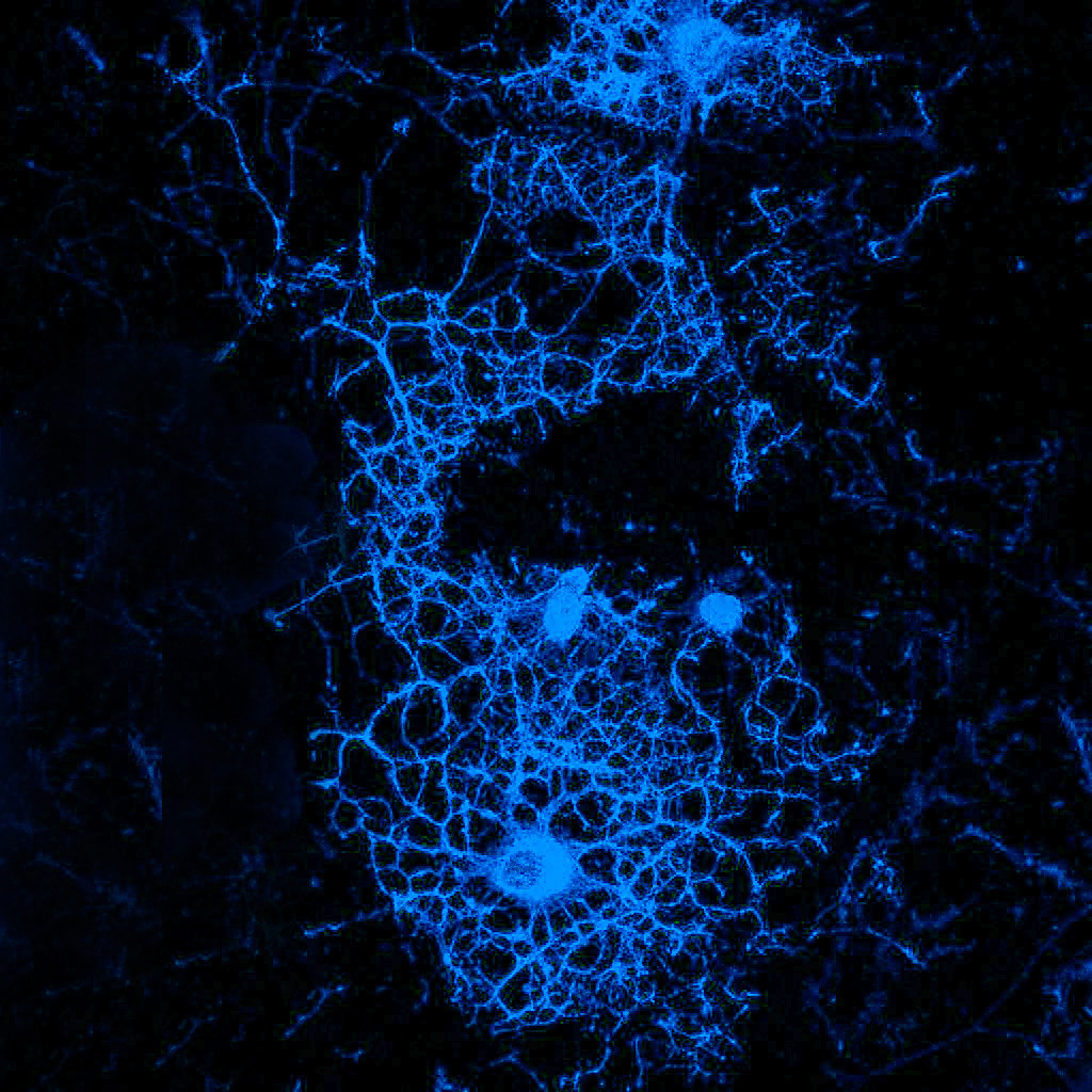 Oligodendrocytes